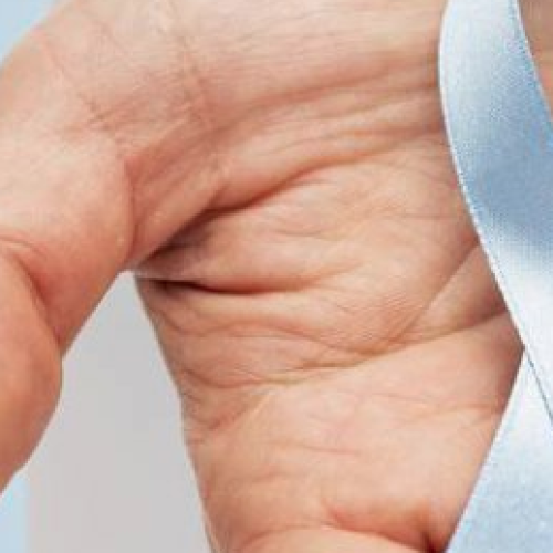 Lilt, la Reggia in azzurro per la prevenzione ai tumori maschili